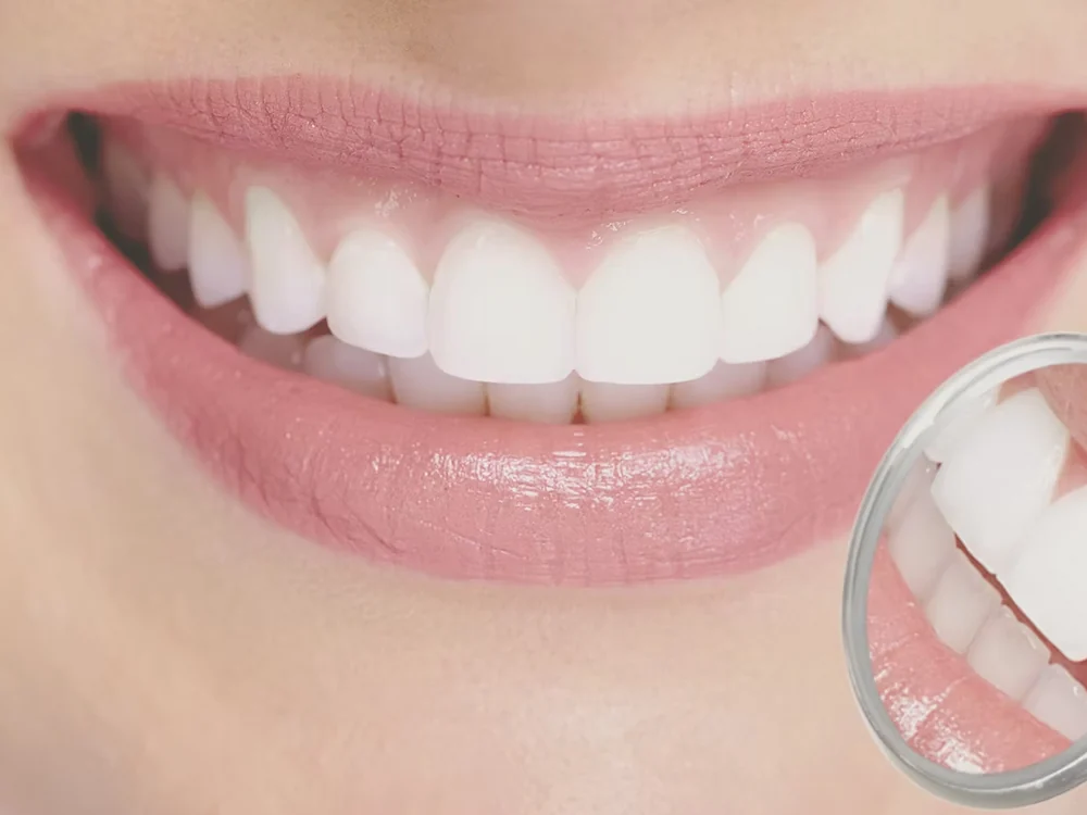 Sorriso e estética dental